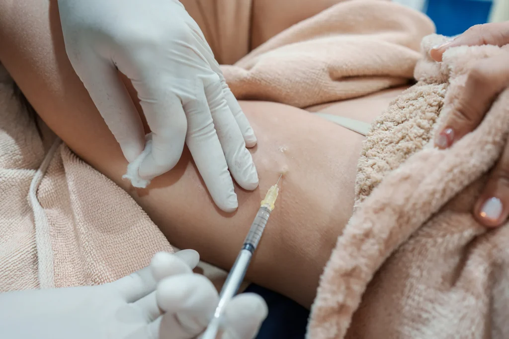 A person receiving a fat dissolving treatment, with a healthcare professional administering the injection in the arm.