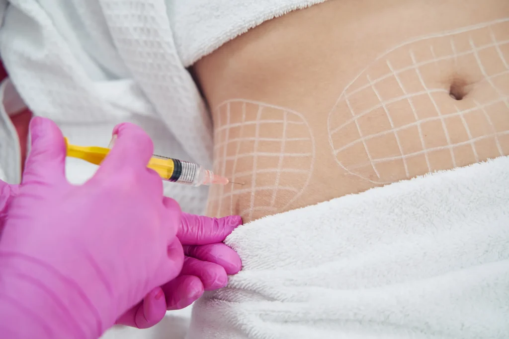 Hijamah Wet Cupping, Fat Dissolving & Aesthetics | Clinic 27:7 A person receiving a fat dissolving treatment, with a healthcare professional administering the injection in the waistline.